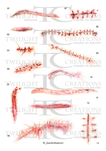 Scars And Sutures A