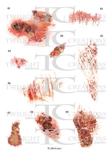 Skin Scrapes 1