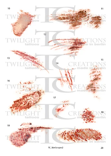 Skin Scrapes 2