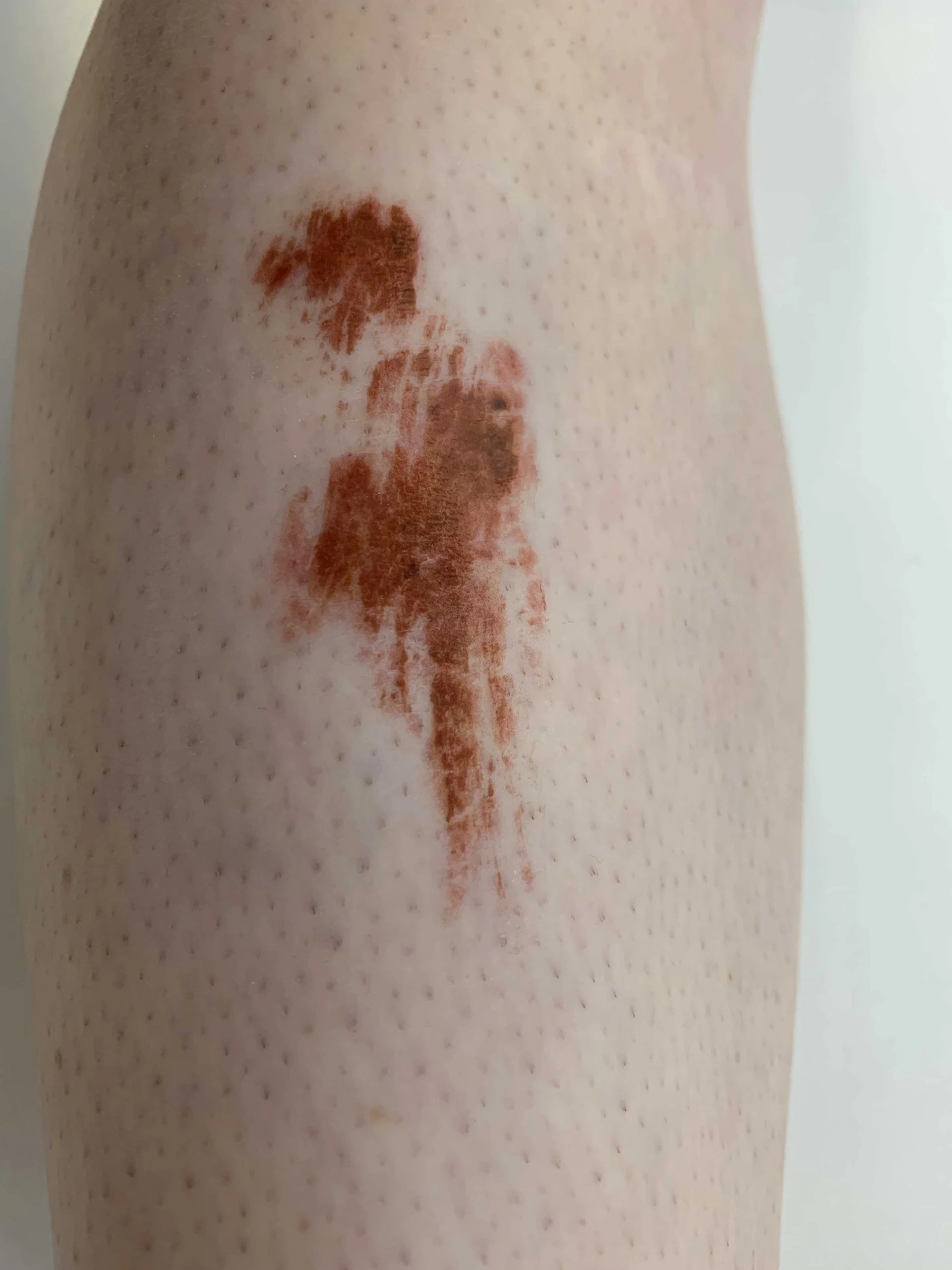 Skin Scrapes 2